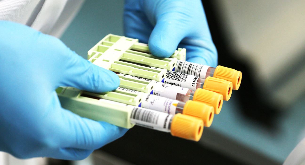 Image of a laboratory technician holding a rack of blood samples.