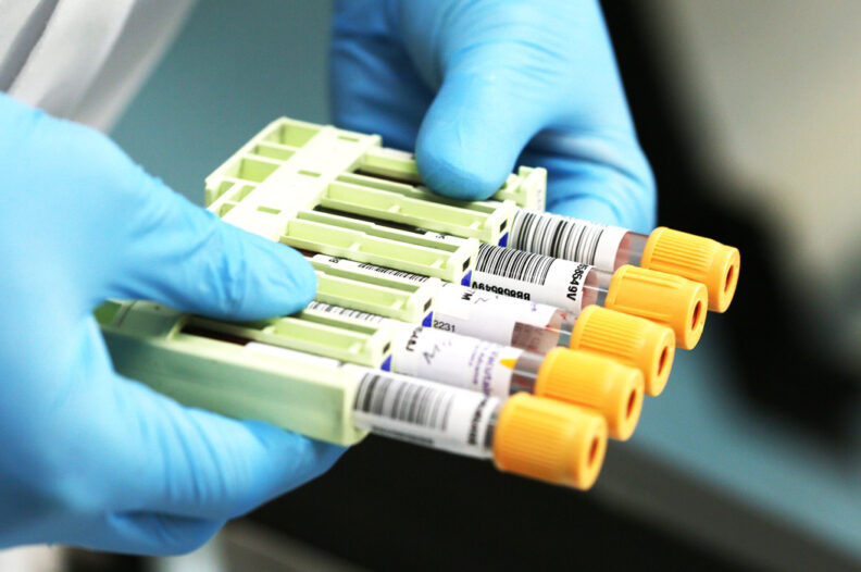 Image of a laboratory technician holding a rack of blood samples.